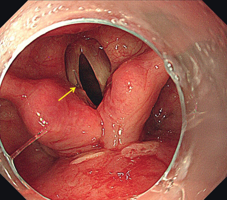 Fig. 3