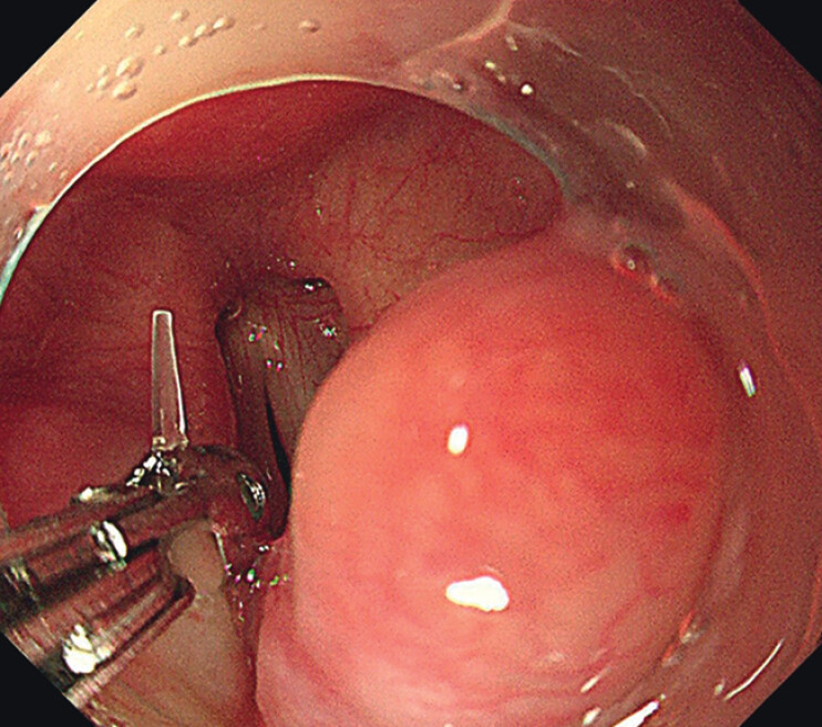 Fig. 4