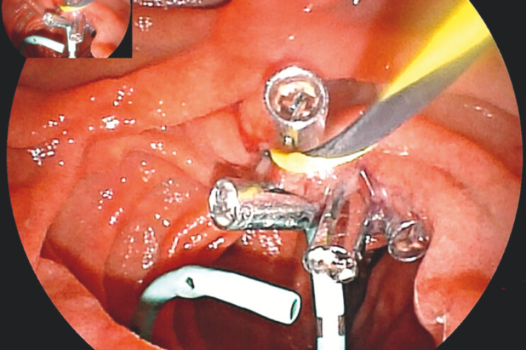 Fig. 4