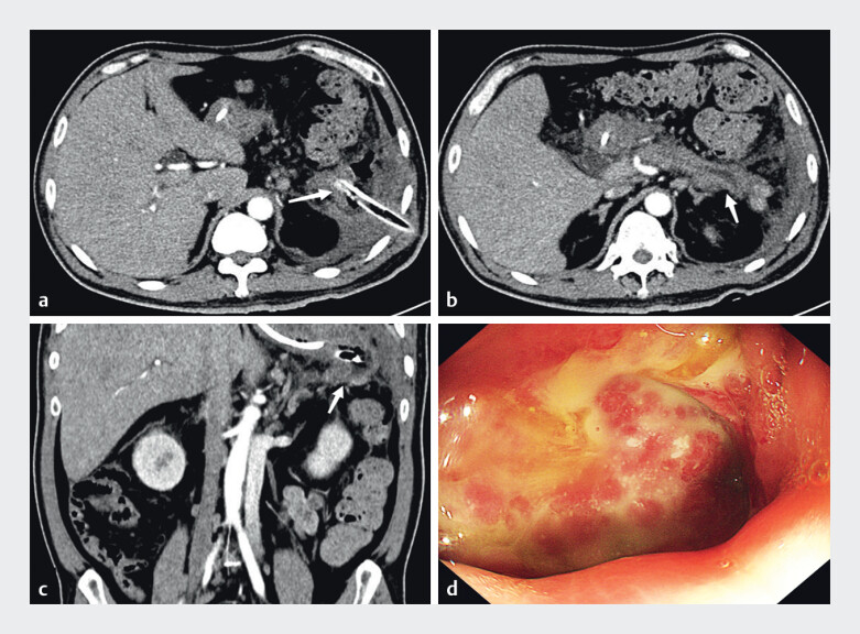 Fig. 4