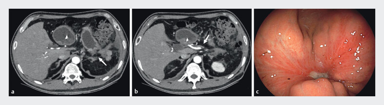 Fig. 5