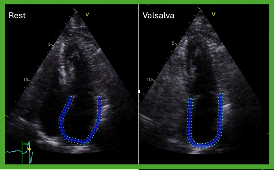 Figure 14