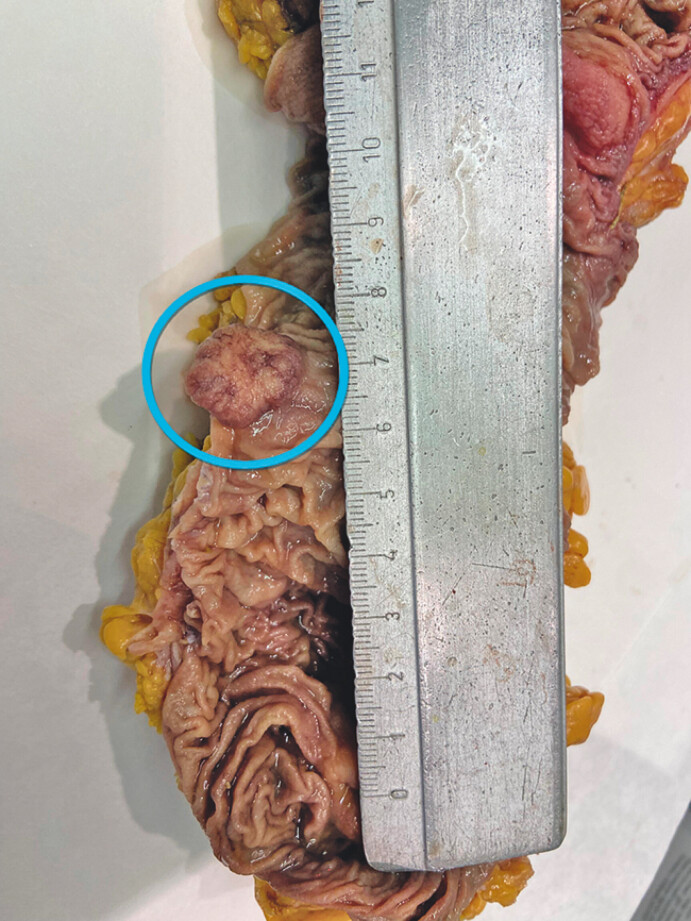 Fig. 2