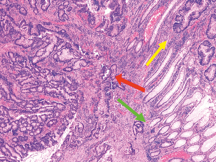 Fig. 4
