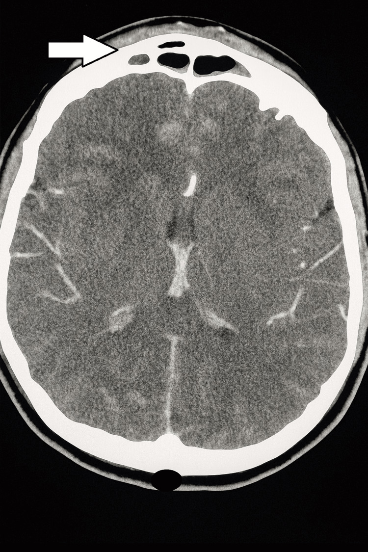 Figure 6