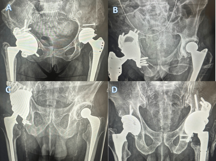 Figure 4