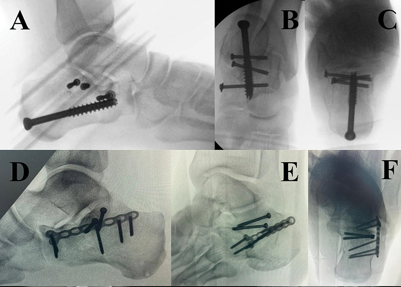 Fig. 4