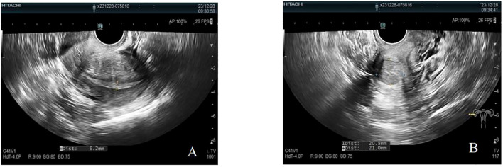 Figure 2