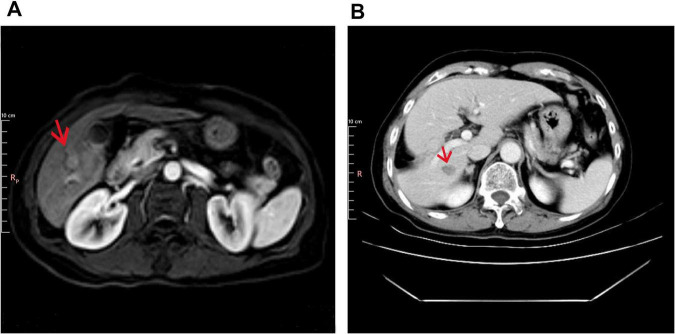 FIGURE 1