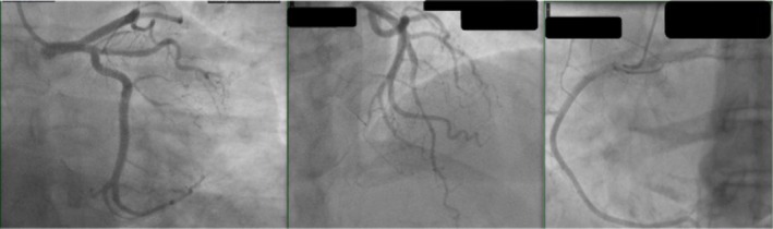 FIGURE 2