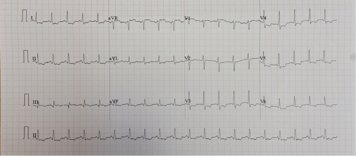 FIGURE 1