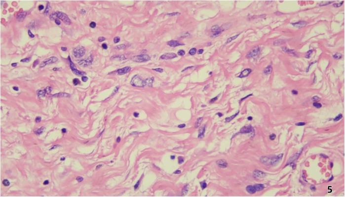 Figure 5