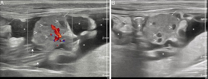 FIGURE 2