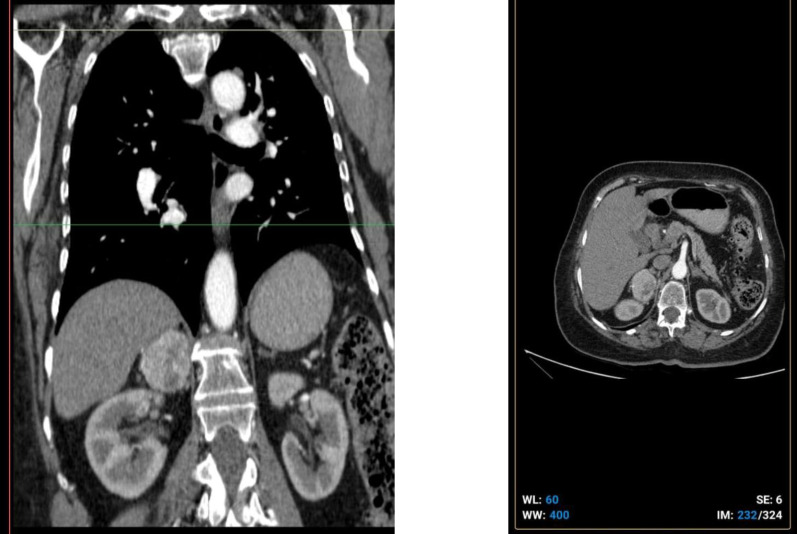 Fig.1