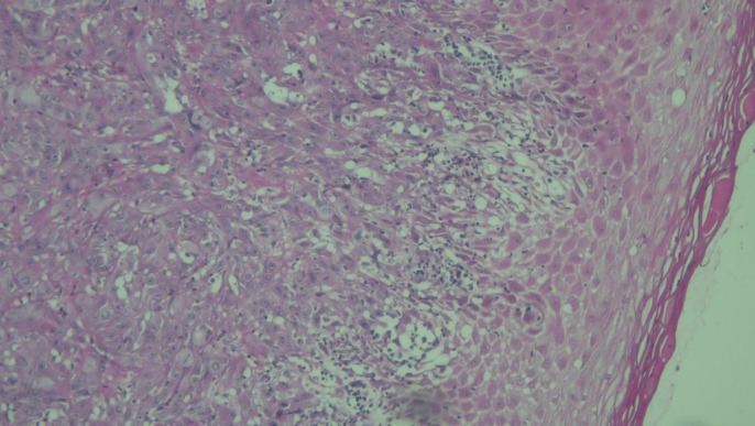 Fig 4