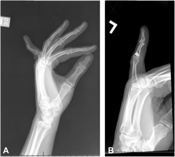 Figure 5