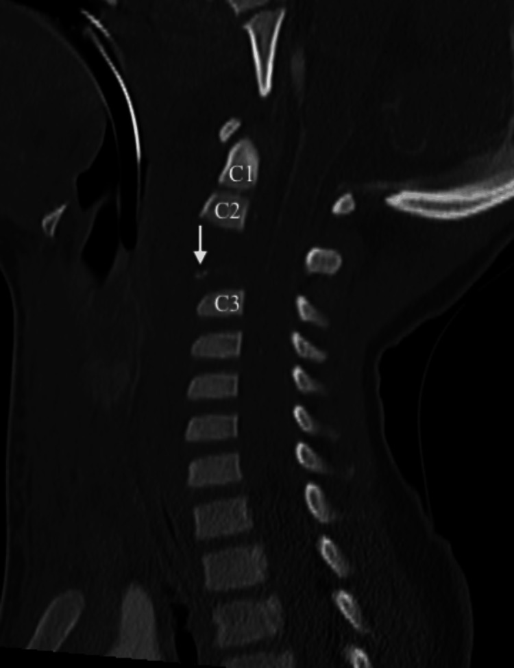 Figure 2