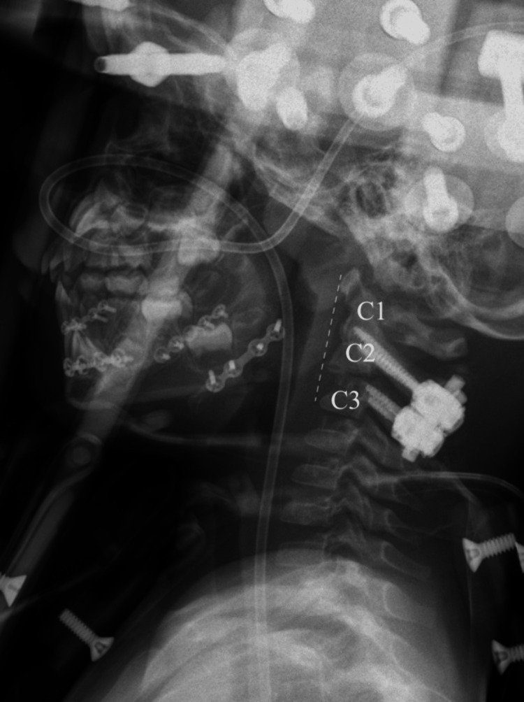 Figure 9