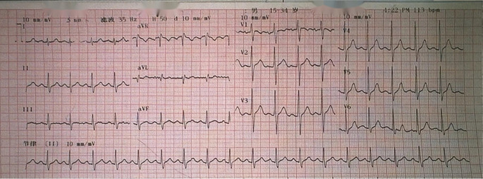 Figure 2