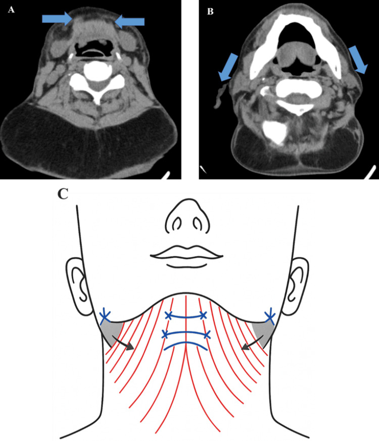 Figure 13