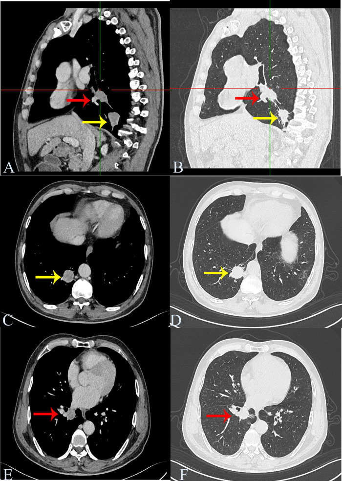 Figure 1