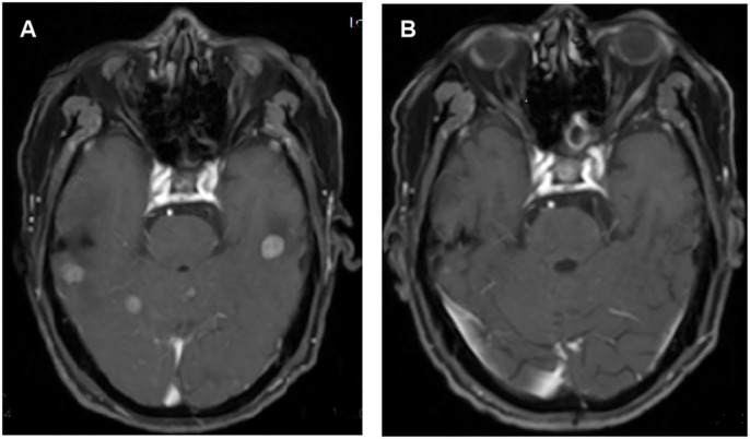 Figure 2