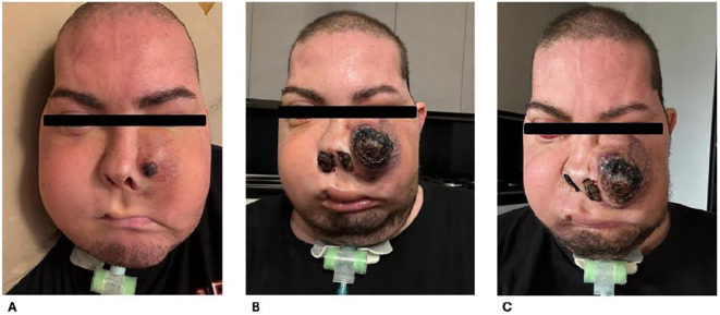 Figure 3
