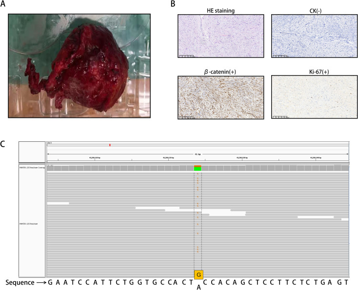 Figure 2