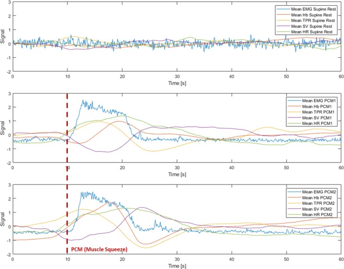 FIGURE 3