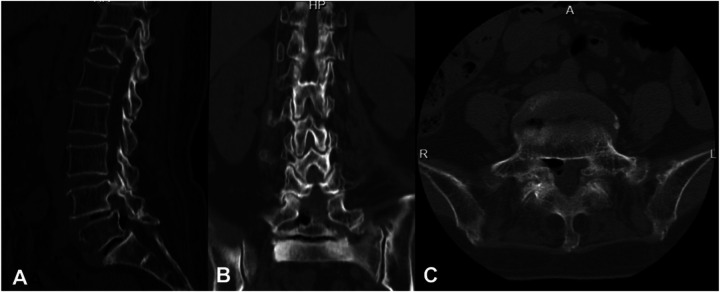 Figure 2