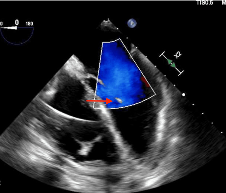 Figure 4
