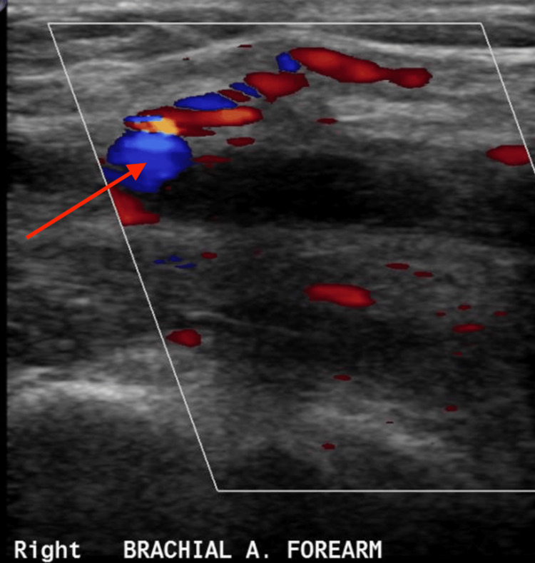 Figure 5