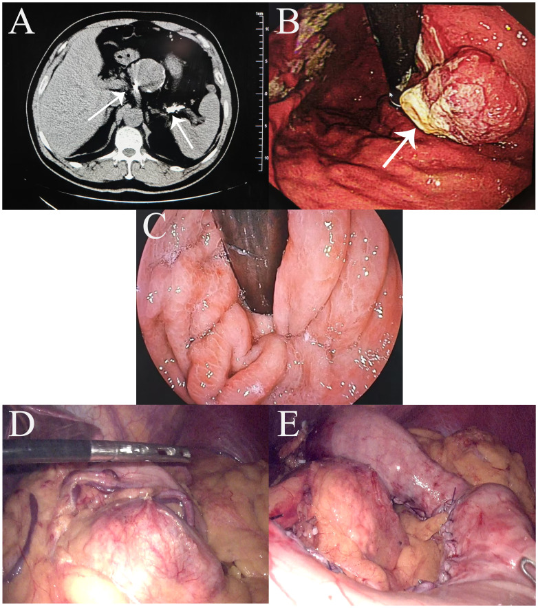 Figure 1
