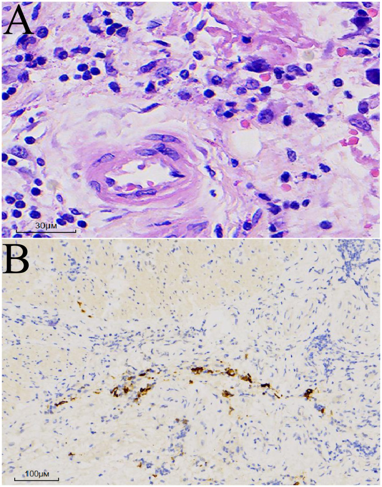 Figure 3