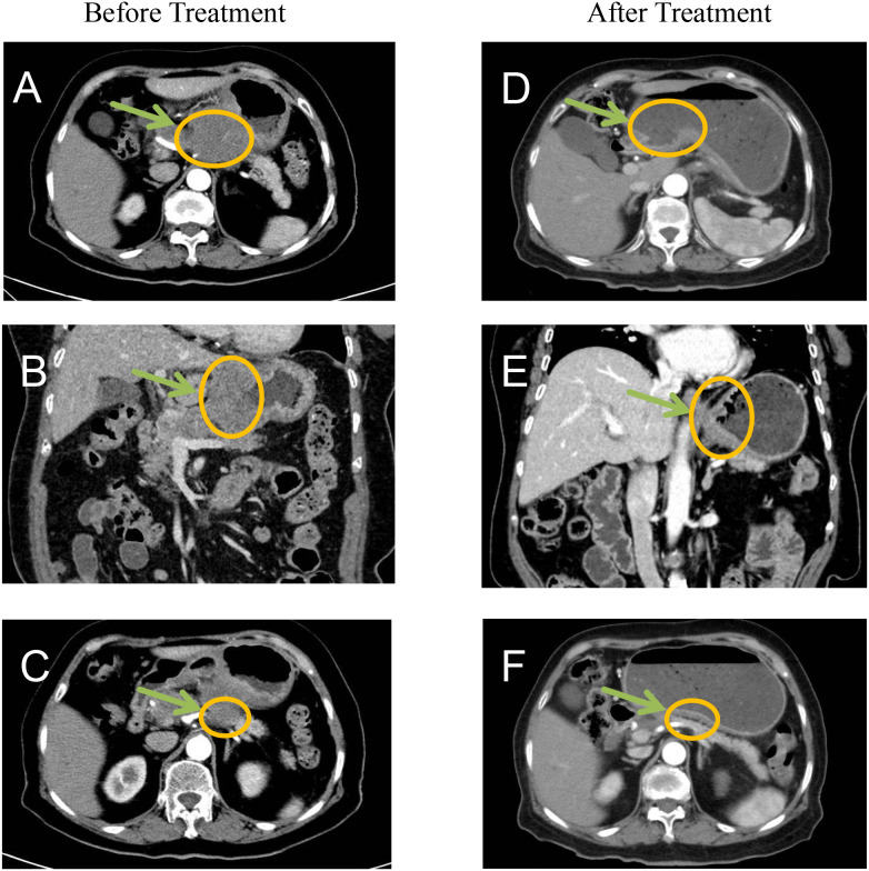 Figure 3