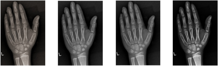 Figure 2