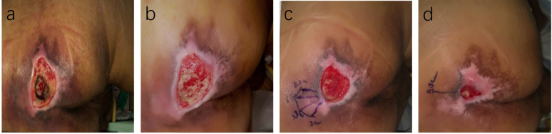 Figure 6