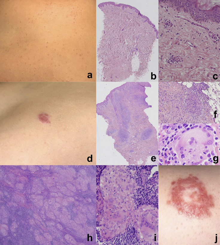 Figure 1