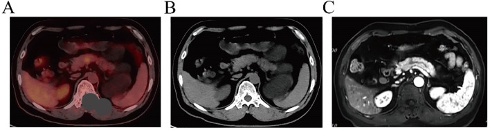Figure 1