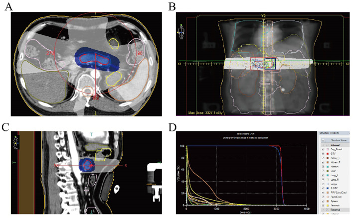 Figure 2
