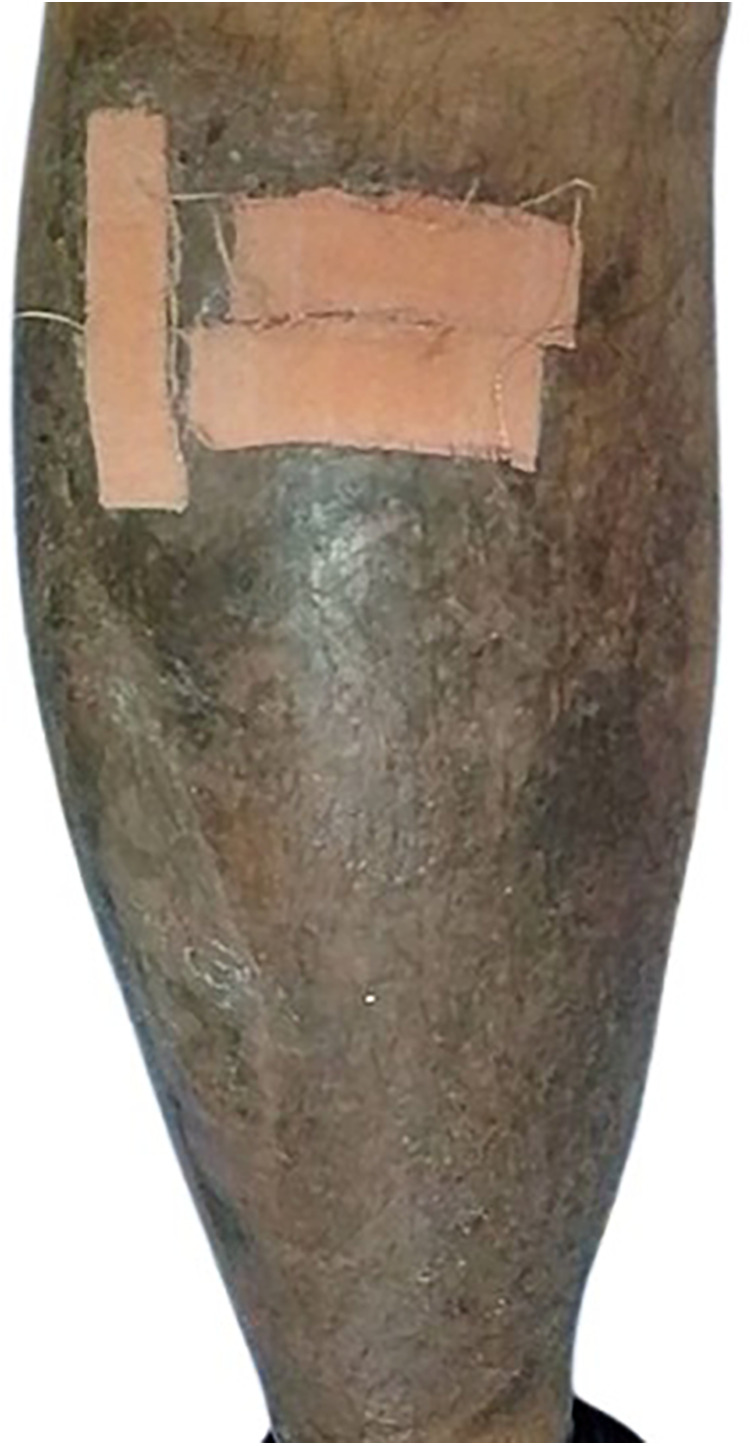Figure 4