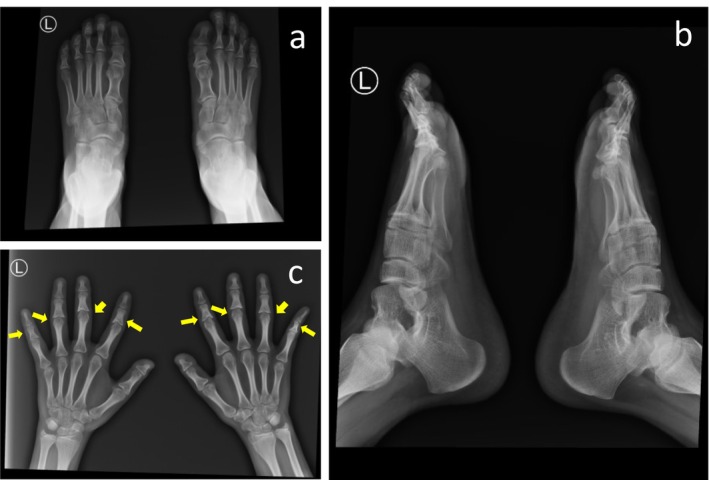FIGURE 3