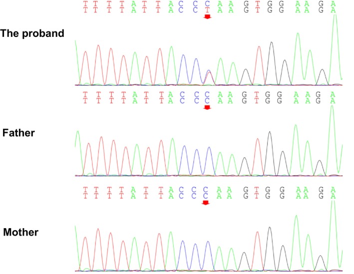 FIGURE 4
