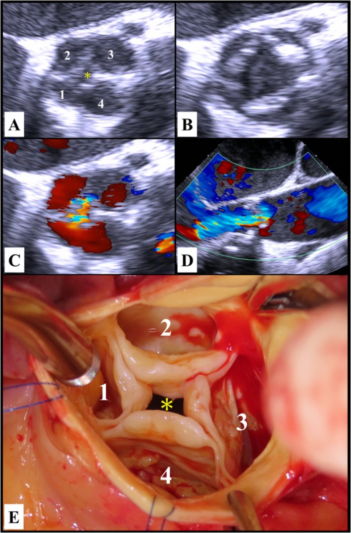 FIGURE 1