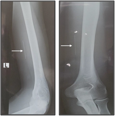 FIGURE 2