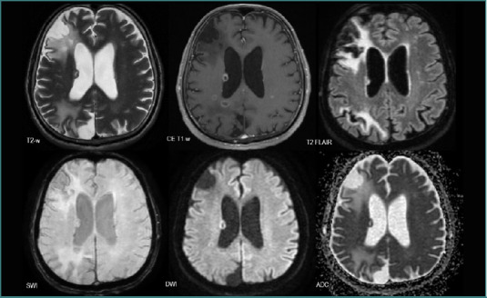 Figure 13