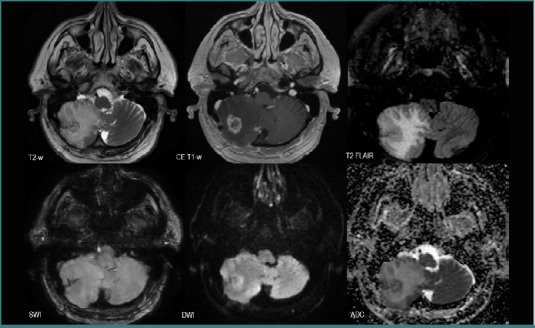 Figure 14