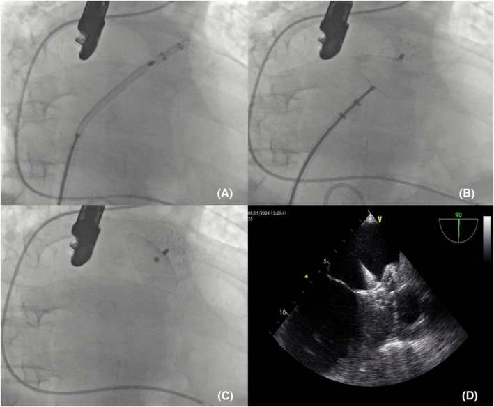 FIGURE 4