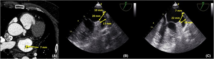 FIGURE 1