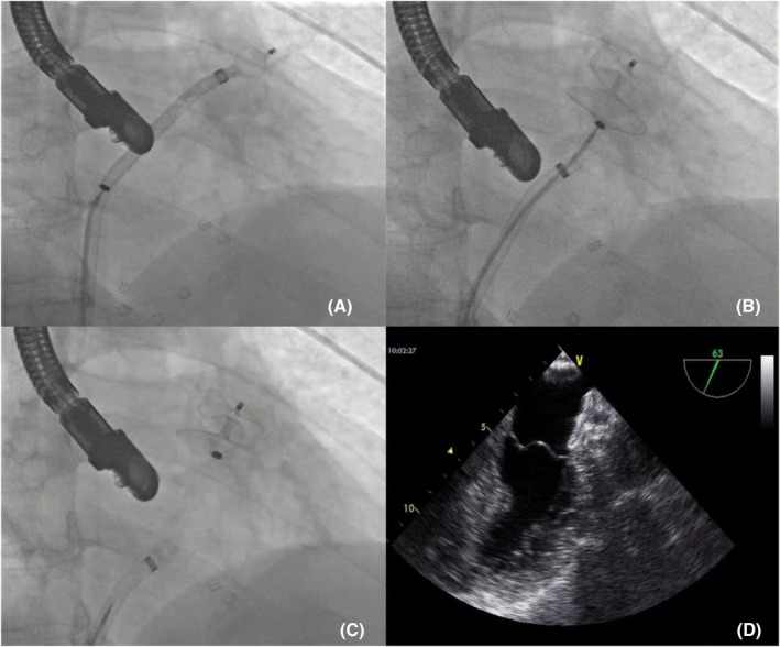FIGURE 2